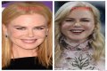 Nicole Kidman's "Lioness" Plastic Surgery: Uncovering Hidden Truths